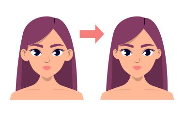 Otoplasty konsept vektörü izole edildi. Estetik ameliyattan önce ve sonra. Göze çarpan kulakların boyutları. Güzellik fikri..