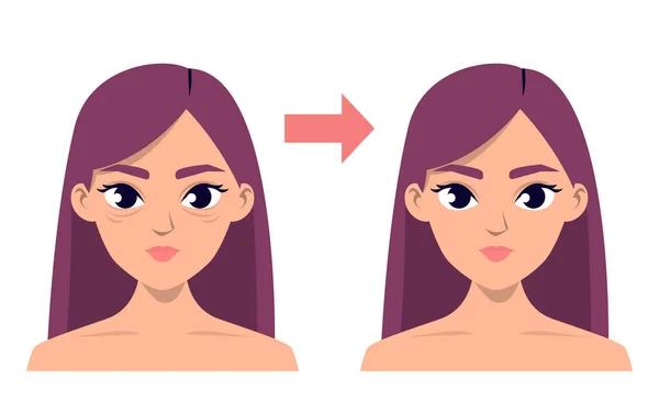 Blepharoplastik Vor Und Nach Vektor Isoliert Medizinische Operation Weibliche Gesichtsveränderung — Stockvektor