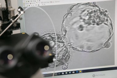 Metalik göz merceğinin yakın fotoğrafını beyaz optik mikroskop ameliyathanede steril tutuyor. İlaç araştırma konsepti için tıbbi biyoloji aygıtı teknolojisi ekipmanı.