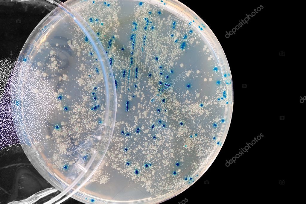 Bacteriophage plaques during titer test Stock Photo by ©motorolka 126576240