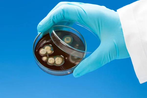 Nitril Eldiven Elinde Tutan Petri Dish Ile Bakteri Kolonileri — Stok fotoğraf