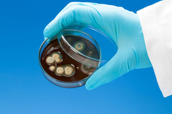 Hand in nitril glove holds Petri dish with bacterial colonies