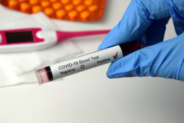 Coronavirus kan testi pozitif.