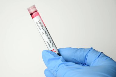 Coronavirus kan testi pozitif.