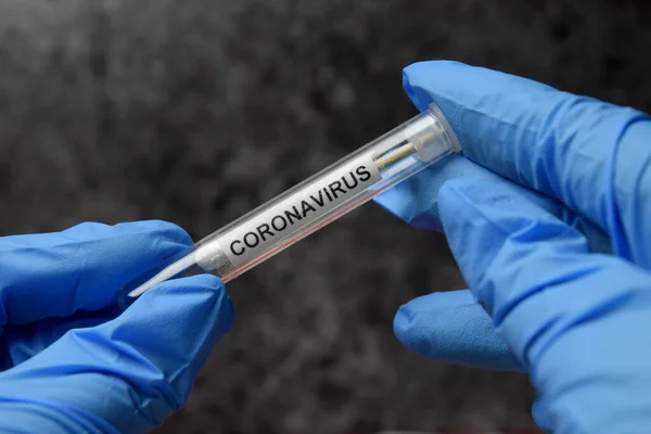 Coronavirus test dünyası yeni pandemia