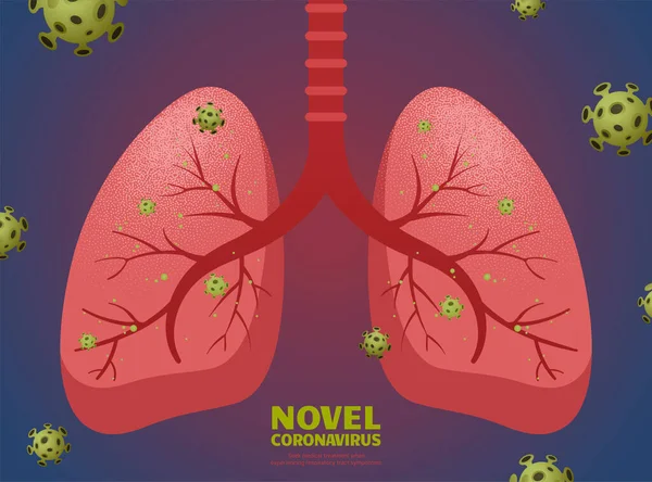 Nuevo Coronavirus Pulmones Sobre Fondo Púrpura — Vector de stock