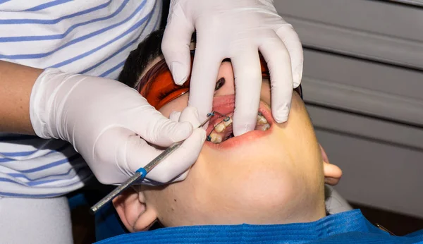 Rapaz em tratamento dentário. Braçadeira. cuidados de saúde — Fotografia de Stock