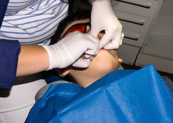 Rapaz em tratamento dentário. Braçadeira. cuidados de saúde — Fotografia de Stock