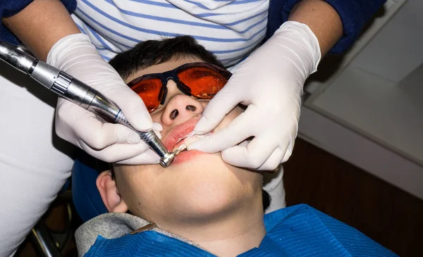 Rapaz em tratamento dentário. Braçadeira. cuidados de saúde — Fotografia de Stock