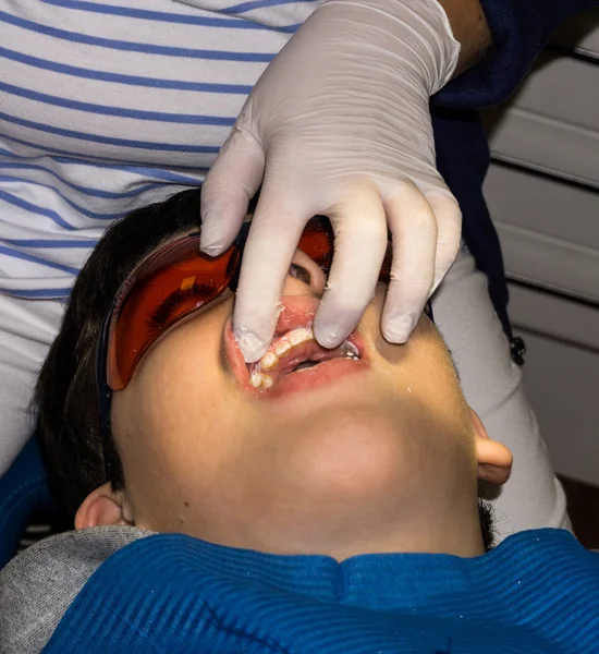 Rapaz em tratamento dentário. Braçadeira. cuidados de saúde — Fotografia de Stock