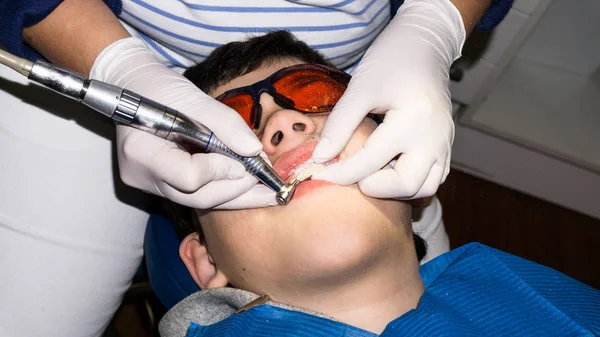 Rapaz em tratamento dentário. Braçadeira. cuidados de saúde — Fotografia de Stock