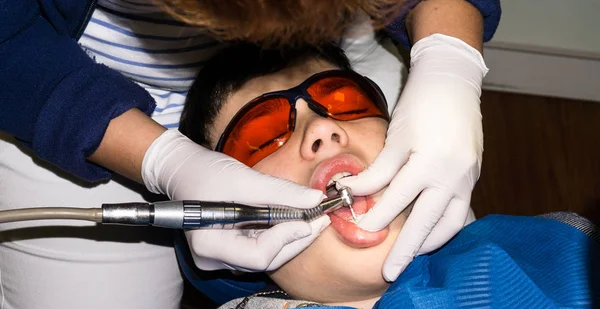 Rapaz em tratamento dentário. Braçadeira. cuidados de saúde — Fotografia de Stock