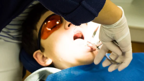 Rapaz autista em tratamento dentário. Braçadeira. cuidados de saúde — Fotografia de Stock