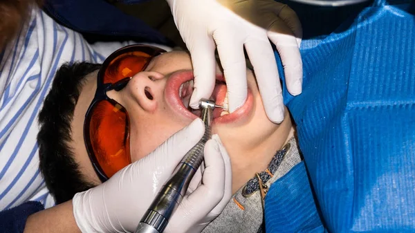 Rapaz em tratamento dentário. Braçadeira. cuidados de saúde — Fotografia de Stock