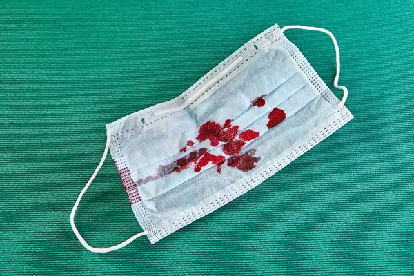 A used surgical mask or a disposable facemask with blood stains. Personal protective equipment after use by an infected patient during a coronavirus infection pandemic, or covid-19.