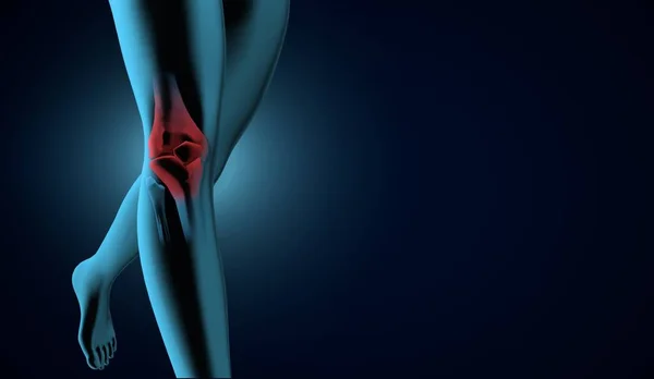 Human Legs Knees Ray Looking Illustration Illustration Blue Red Black — Stock Photo, Image