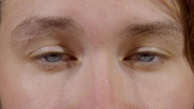 Uykulu Gözlü Kadın