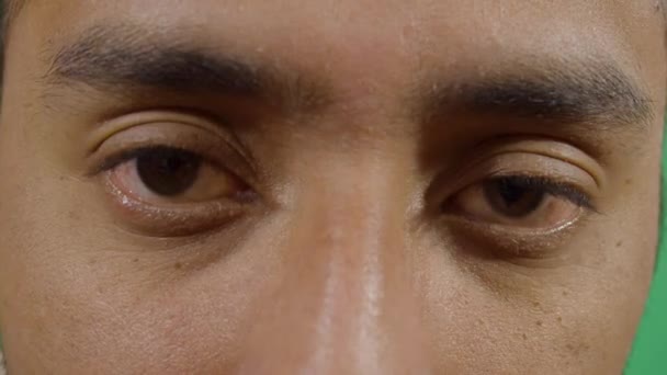 Hombre adulto con ojos somnolientos — Vídeos de Stock