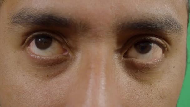Yetişkin Adam Gözlerini Çeviriyor — Stok video