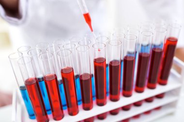 Kan örneği pipet ile alarak