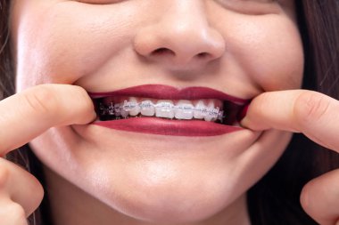 Showing off with a beautiful smile