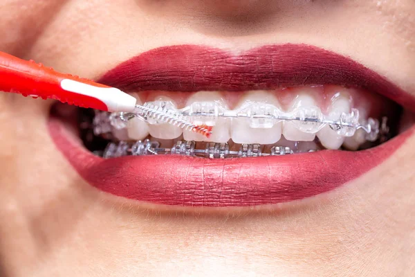 Proxabrush for in between teeth area hygiene — Stockfoto