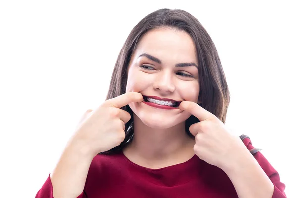 Beautiful young woman showing her teeth with braces — ストック写真