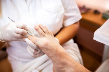 Ayak baş parmağı pedikürü, tırnak tedavisi, erkek pedikürü, tırnak törpüsü.