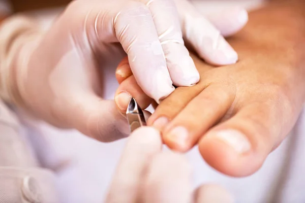 Trattamento Delle Cuticole Concetto Pedicure Concetto Unghie Dall Aspetto Pulito — Foto Stock