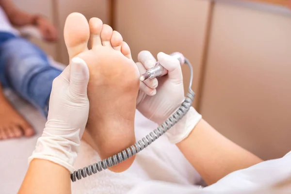 Skin filing of the lateral sole foot area in pedicure salon