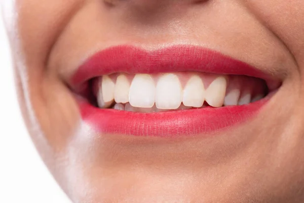 Primo Piano Sorriso Con Denti Bianchi Belle Labbra — Foto Stock