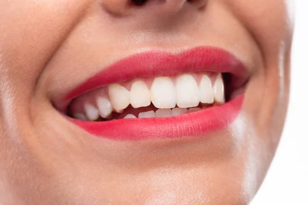 Primer Plano Labios Bonitos Hermosa Sonrisa Dientes Sanos Higiene Bucal — Foto de Stock