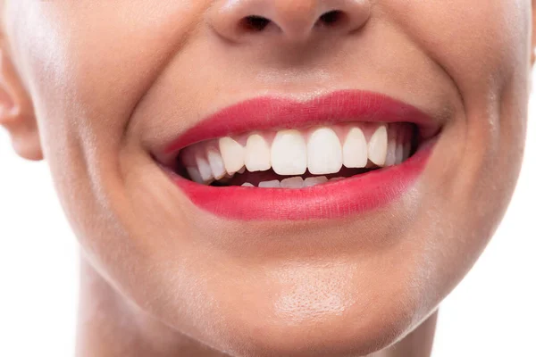 Primer Plano Labios Bonitos Hermosa Sonrisa Dientes Sanos Higiene Bucal — Foto de Stock