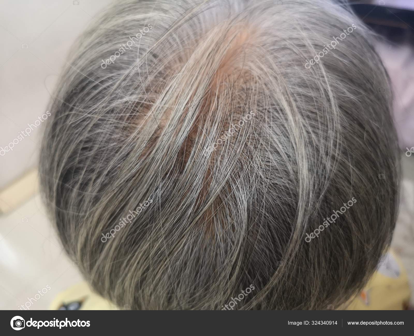 Gray Hair Women Become Older Hair Head Become White Stock Photo by  ©penpakn@ 324340914