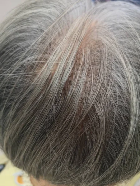 Cabello Gris Las Mujeres Envejecen Cabello Cabeza Volverá Blanco —  Fotos de Stock