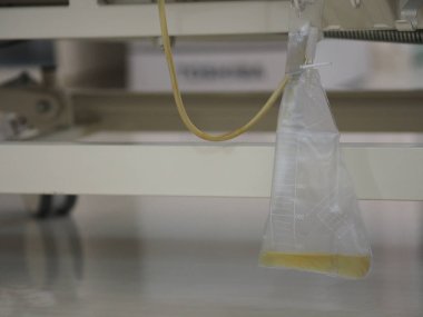 İdrar kateterizasyonu idrar torbası hastayı hastaneye asın.