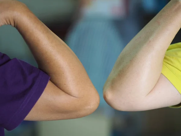 Alternative Handshakes Elbow Bump Greeting Situation Epidemic Covid Coronavirus — Stock Photo, Image