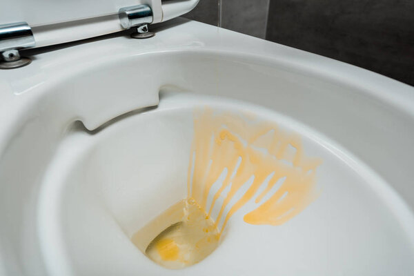 close up view of yellow liquid detergent in ceramic clean toilet bowl in modern restroom with grey tile