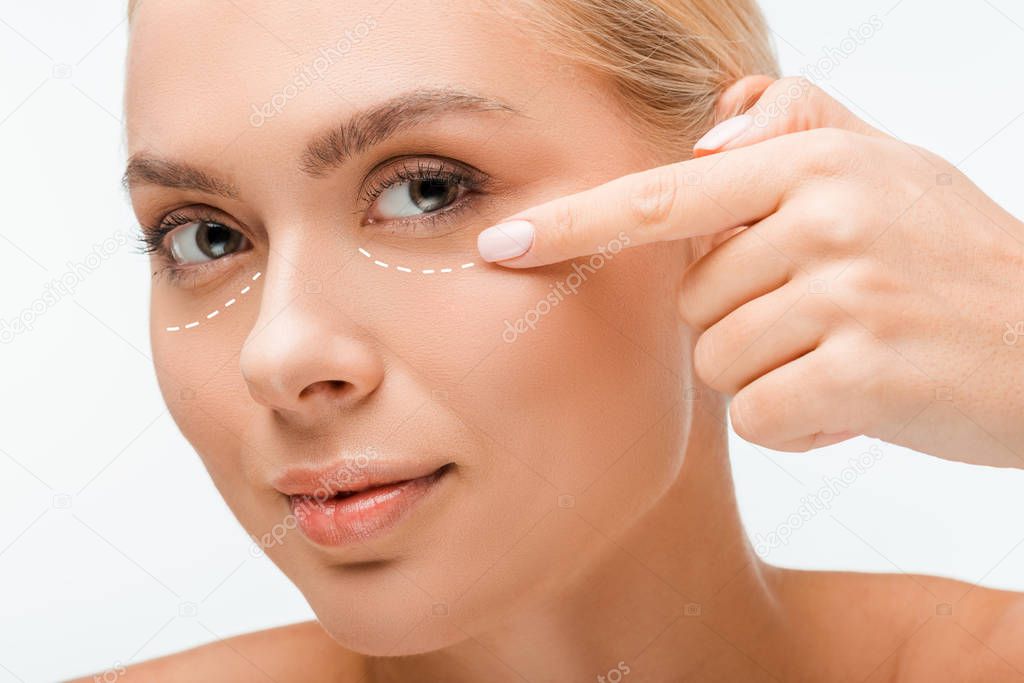 beautiful woman pointing with finger at plastic surgery marks under eyes isolated on white 