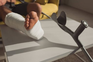 Cropped view of man with broken leg on coffee table near crutch 