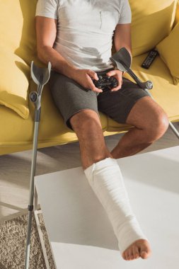 KYIV, UKRAINE - JANUARY 21, 2020: Cropped view of man with broken leg playing video game near crutches and remote controller on couch
