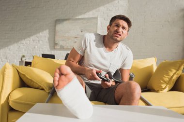 KYIV, UKRAINE - JANUARY 21, 2020: Selective focus of angry man with broken leg playing video game on sofa at home