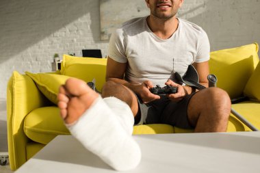 KYIV, UKRAINE - JANUARY 21, 2020: Selective focus of smiling man with leg in plaster bandage on coffee table playing video game at home