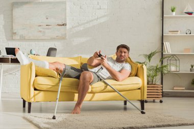 KYIV, UKRAINE - JANUARY 21, 2020: Upset man with broken leg playing video game on couch in living room