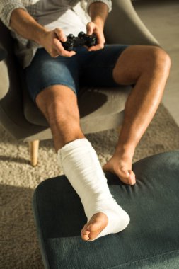 KYIV, UKRAINE - JANUARY 21, 2020: Selective focus of man with broken leg playing video game in armchair