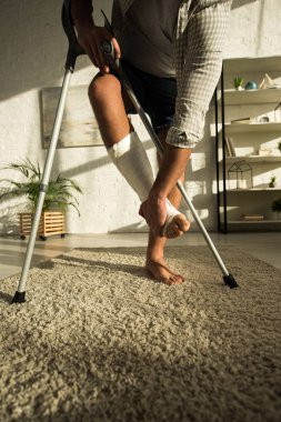 Cropped view of man touching broken leg and holding crutches in living room