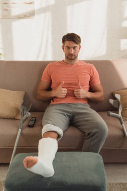Handsome man with leg in plaster bandage showing thumbs up on couch
