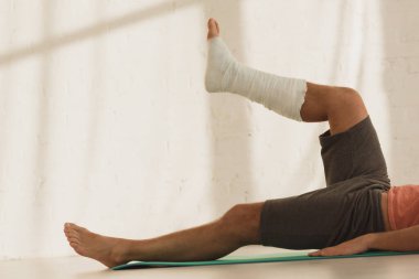 Cropped view of man with broken leg training on fitness mat at home