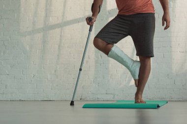 Cropped view of man with broken leg standing on fitness man and holding crutch  clipart