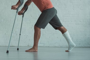 Side view of man with broken leg in gypsum holding crutches at home